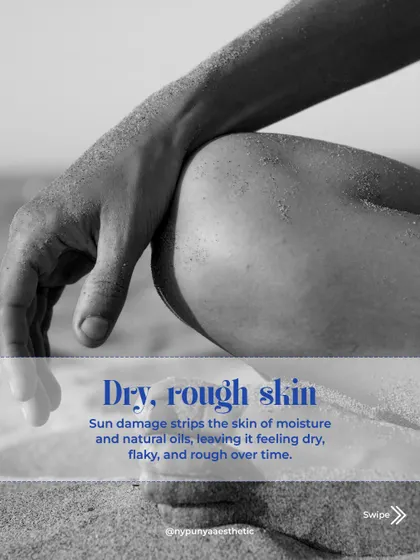 Sun damage also strips the skin of moisture and natural oils. Over time, this leads to a dry, flaky, and rough skin texture.