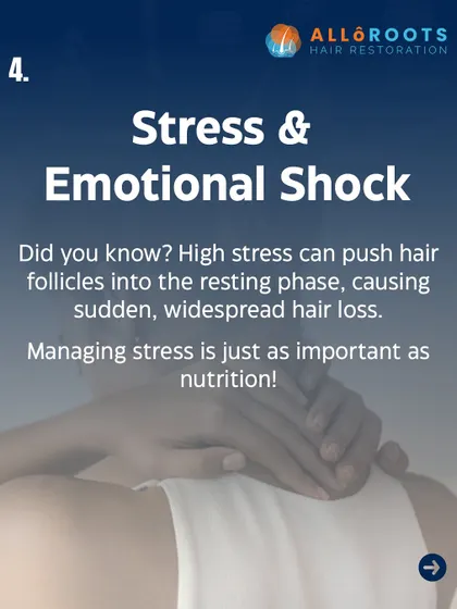 Sudden emotional shock or chronic high stress can trigger widespread hair loss. Stress hormones like cortisol can force a large number of hair follicles into the resting phase at once, causing noticeable shedding. Managing stress is as important as any other treatment.