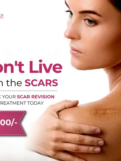You don't have to live with scars. We offer scar revision treatments designed to improve the appearance of scars on the face and body, helping you feel more confident in your skin.