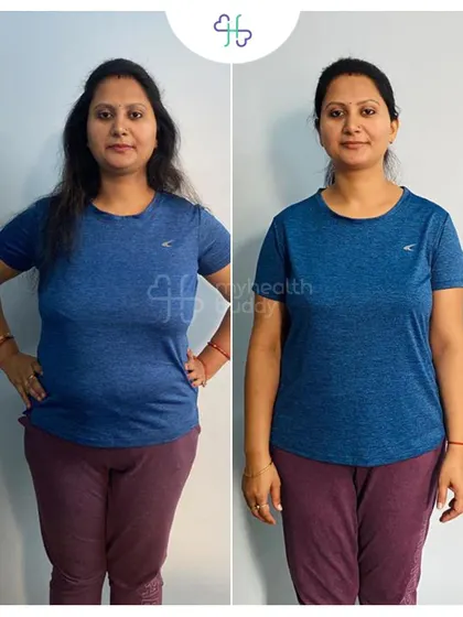 A front view of Rashmi's 15kg weight loss. She was stuck at 92kg before starting and was amazed at the results she could achieve with the right guidance.