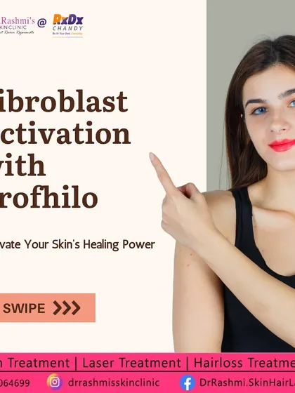 This post explains how Profhilo activates fibroblasts, the cells in your skin responsible for producing collagen and elastin. By stimulating these cells, we enhance your skin's natural ability to repair and rejuvenate itself.