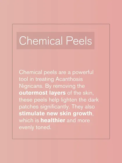 Chemical peels are a powerful tool for treating Acanthosis Nigricans. By removing the outermost layers of skin, these peels help lighten the dark patches and stimulate new, healthier skin growth.