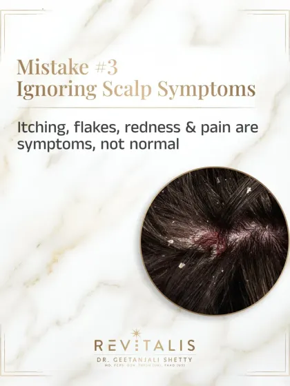 Itching, flakes, and redness are not normal. These are symptoms of an underlying scalp issue like seborrheic dermatitis or fungal infections. Ignoring them allows the problem to worsen and can impact hair growth.