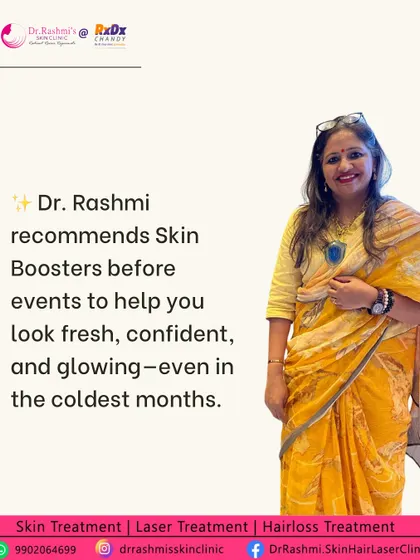 A post featuring me, recommending Skin Boosters as an ideal treatment before events to look fresh, confident, and glowing.