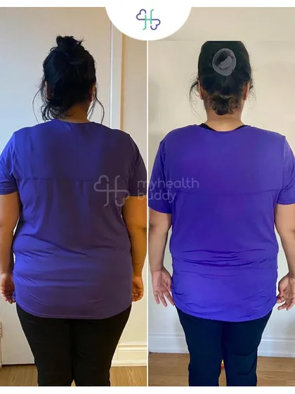 Back view of her 10 kg transformation. Her journey shows that a realistic and doable plan is the key to consistency.