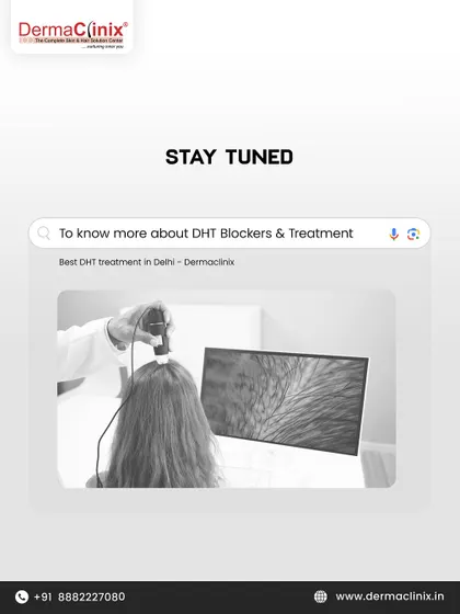 Stay tuned to learn more about DHT blockers and treatments. An early scalp analysis can make all the difference.