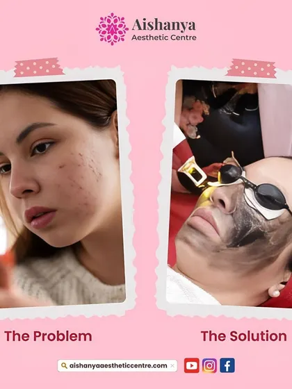 This graphic illustrates the problem of common skin concerns and presents my clinic as the solution. I am here to help you achieve your beauty goals with personalized care.