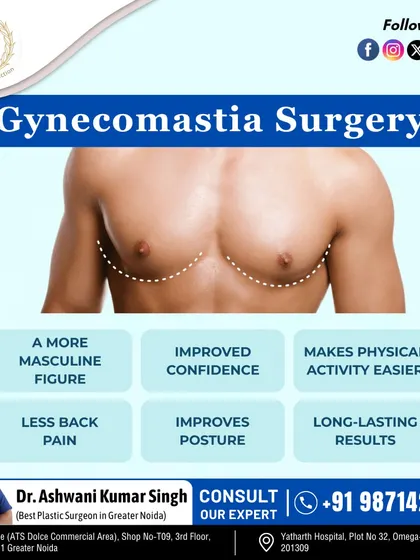 Gynecomastia surgery offers many benefits beyond appearance. It can lead to improved confidence, better posture, less back pain, and make physical activities easier and more comfortable.