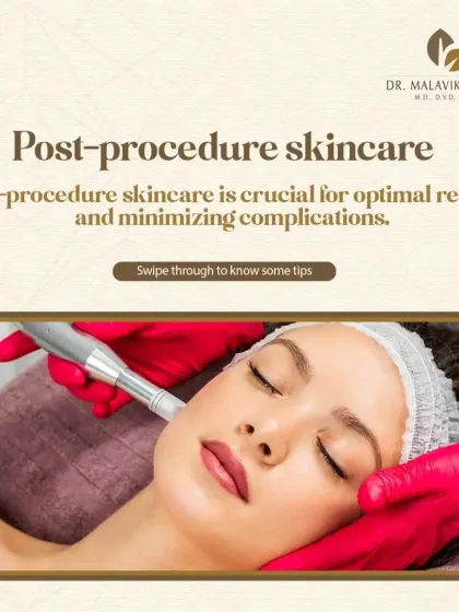 After any clinical procedure, your skincare routine is key to minimizing complications and achieving the best outcome. This post introduces some essential tips for post-procedure care.