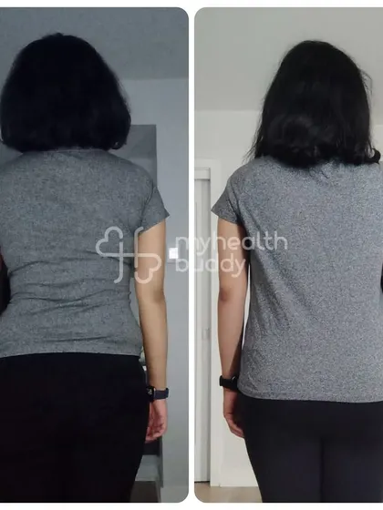 After trying many diets, this client finally learned how to lose weight sustainably, losing 7 kgs in 6 months and gaining energy.