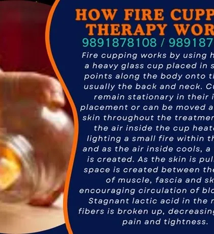 This graphic explains how fire cupping works. The heat creates a vacuum that pulls up the skin, fascia, and muscle layers, encouraging blood flow and breaking up stagnant lactic acid to decrease muscle pain and tightness.