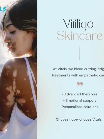 At my clinic, we blend cutting-edge vitiligo treatments with empathetic care. We provide advanced therapies, emotional support, and personalized solutions because we believe in offering hope and results.