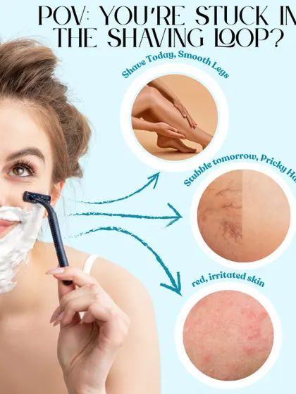 Are you stuck in the shaving loop? This graphic illustrates the frustrating cycle of temporary smoothness followed by stubble and irritation. Laser hair removal is the way to break free.