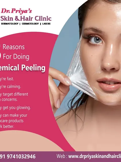 This graphic outlines five key reasons for undergoing a chemical peel. The treatment is fast, calming, targets different concerns, gets you glowing, and can make your other skincare products work more effectively.