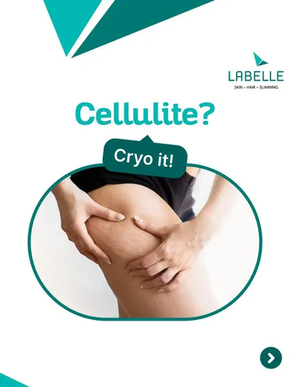 Have cellulite on your thighs or arms? Cryo it! Our Cryolipolysis treatment is an effortless and simple way to reduce fat and cellulite from specific areas, helping you achieve a smoother look.