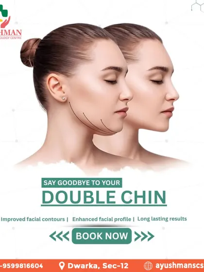 A defined jawline can dramatically enhance your facial profile. We offer specialized, non-surgical double chin reduction treatments designed to target submental fat, resulting in improved facial contours and a sharper, more confident look with long lasting results.