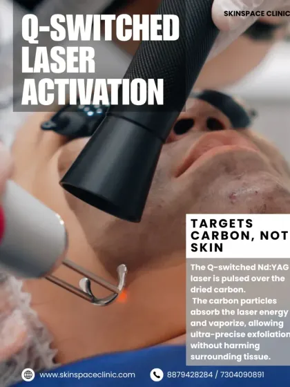 Next, we use a Q-switched Nd:YAG laser pulsed over the dried carbon. The carbon particles absorb the laser energy and vaporize, allowing for a precise exfoliation that doesn't harm the surrounding healthy skin tissue.