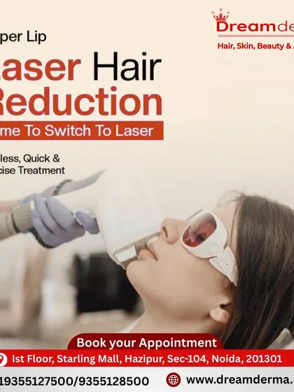 Tired of the constant pain from threading or waxing your upper lip? My laser hair reduction for the face is a precise and quick alternative. The treatment uses a cooling tip to ensure the process is painless, making it a popular choice for sensitive areas.