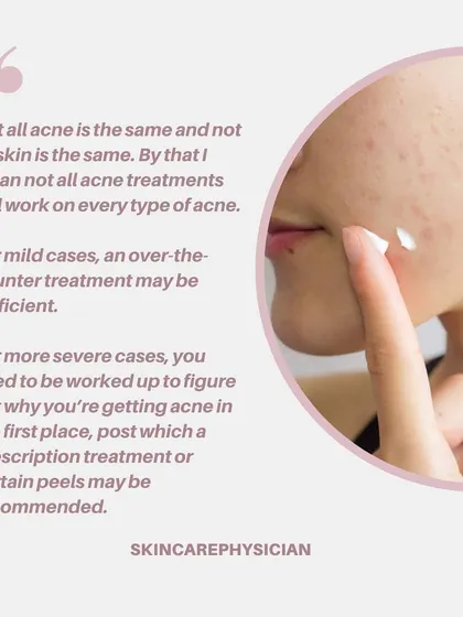 Not all acne is the same, and treatment must be personalized. While mild cases might respond to over-the-counter products, more severe acne requires a professional diagnosis and prescription-strength treatment plan.