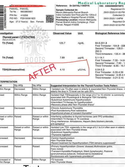 After: Within less than a month of treatment, her TSH level dropped to a healthy 4.10, showing a rapid response to the Ayurvedic plan.