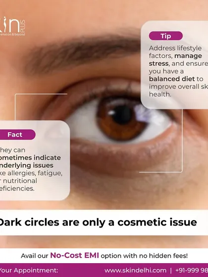 A factual graphic explaining that dark circles can sometimes indicate underlying issues like allergies, fatigue, or nutritional deficiencies, not just a cosmetic concern.