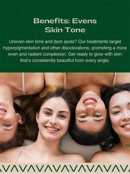 For those with uneven skin tone and dark spots, my treatments target hyperpigmentation. I work to promote a more even and radiant complexion.