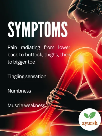 Recognizing the symptoms of Sciatica is key to getting the right treatment. These include pain radiating from the lower back to the toe, a tingling sensation, numbness, and muscle weakness in the affected leg.