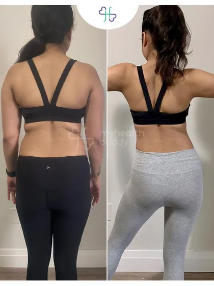 Back view of her 5 kg transformation. Notice the defined back and glutes from heavy weight lifting.