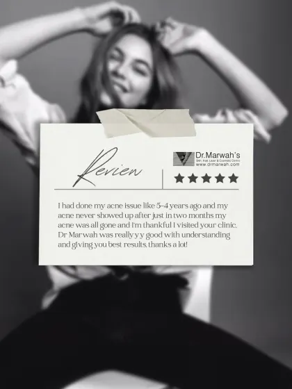 This patient review highlights a 5-year struggle with acne that was resolved within months at our clinic. It is a testament to our focus on understanding the root cause and delivering effective, lasting results.