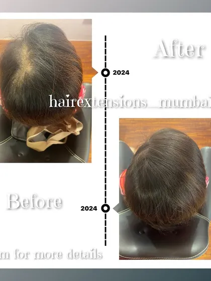 A timeline before and after of a crown topper. This piece was designed to provide coverage and volume for a client experiencing hair thinning.