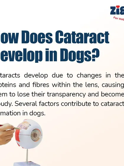 How does a cataract develop? This graphic explains the changes in proteins within the lens that cause it to become cloudy, a process that can be influenced by several factors.