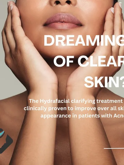 Dreaming of clear skin? The clarifying HydraFacial treatment is clinically proven to improve the overall appearance of skin in patients with acne.