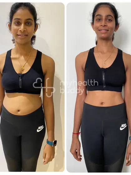 This front view shows the visible reduction in belly fat and increased muscle definition. It's an amazing result from a focused, protein-rich diet and consistent training.