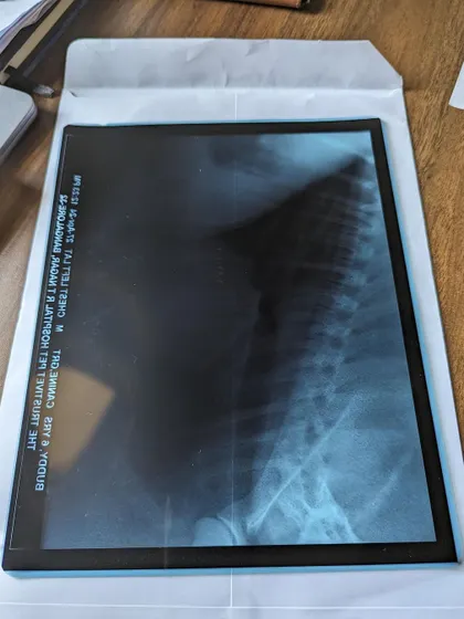 Another photo of Buddy's X-ray used in our appeal.
