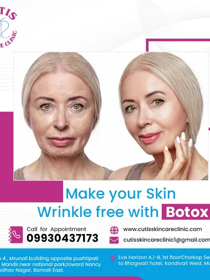 A clear before-and-after comparison demonstrating the effectiveness of our Botox treatment for reducing deep-set wrinkles and fine lines, resulting in a significantly smoother and more youthful complexion.