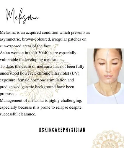 Melasma is a common but complex pigmentation issue, especially for Indian skin. I focus on a comprehensive approach that addresses its causes, including UV exposure and hormonal changes, to manage it effectively.