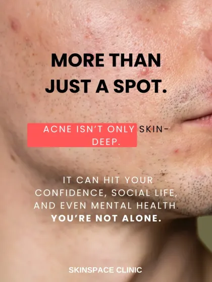 Acne is more than skin-deep. It can significantly impact your confidence and mental well-being. We want you to know that you are not alone, and we are here to provide support and effective medical care.