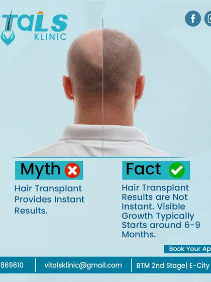 It is important to have realistic expectations. This myth-busting graphic clarifies that hair transplant results are not instant. Visible new growth typically begins around the 6 to 9-month mark, with the final result appearing after a full year.