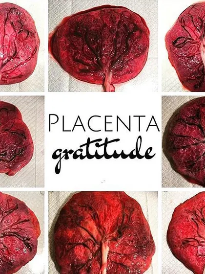The placenta, or "tree of life," is an amazing organ you grow just for your baby. This collage celebrates the uniqueness of each placenta, which nourishes, protects, and provides everything your baby needs to thrive in the womb.