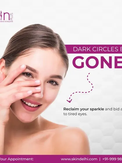 A bold graphic announcing "Dark Circles Be Gone!" It encourages clients to reclaim their sparkle and bid adieu to tired eyes with my specialized treatments.
