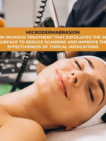 Microdermabrasion is a non-invasive treatment that exfoliates the skin's surface. This helps to reduce scarring, improve skin texture, and increase the effectiveness of topical medications.