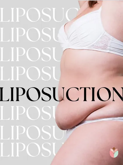 Liposuction is a targeted procedure for removing stubborn pockets of fat that don't respond to a healthy lifestyle. It is not a weight-loss tool but a powerful body sculpting technique to help you achieve a smoother and more defined body shape.
