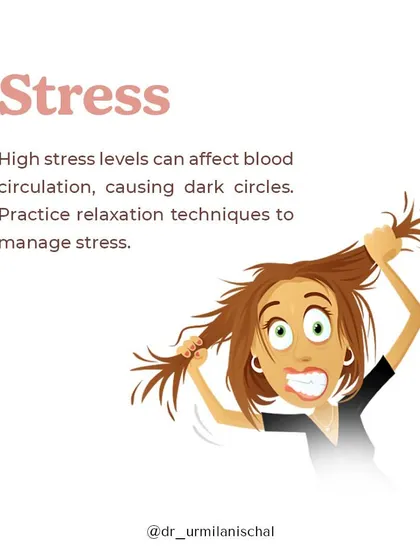 High stress levels increase cortisol, which can affect blood circulation and skin structure, leading to dark circles. I recommend practicing relaxation techniques to manage stress for healthier skin.