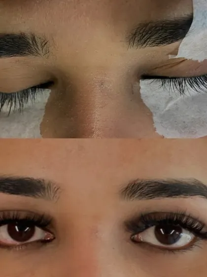 See the difference for yourself. This before and after shows how custom eyelash extensions can completely transform your look, making your eyes appear brighter and more defined without a drop of mascara.