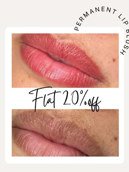 A classic lip blush result, this before-and-after shows the correction of dryness and dullness. The permanent tint adds a flush of color and gives the lips a hydrated, smooth appearance that lasts for up to two years.