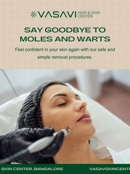 In my clinic, every procedure for mole or wart removal is performed using sterile equipment and proven dermatological techniques. This ensures the treatment is not only effective but also safe and comfortable for the patient.
