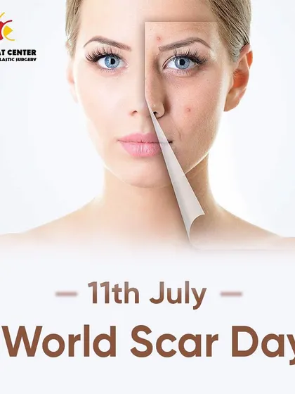 On World Scar Day, we highlight our unique approach to scar treatment. By having both dermatologists and plastic surgeons evaluate each patient, we can create a customized plan that combines the best of non-surgical and surgical methods for optimal results.