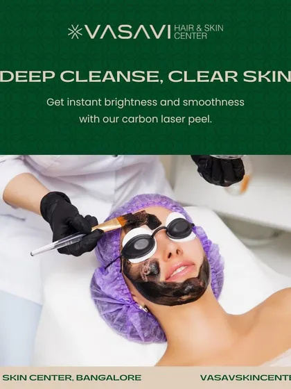 This image shows a Carbon Laser Peel in progress. This is an excellent treatment for achieving a deep cleanse and instant brightness. It is particularly effective for individuals with oily skin, blackheads, and enlarged pores, helping to create a smoother, clearer canvas.