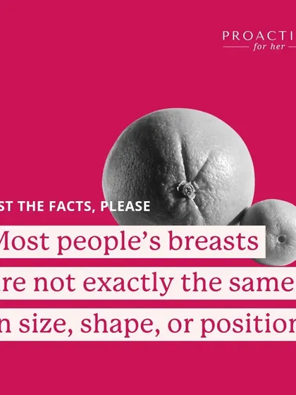 Fact: Most people's breasts are not exactly the same in size, shape, or position. Breast asymmetry is very common and usually not a cause for concern.