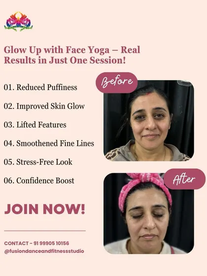 Real results in just one session! This before-and-after from our Face Yoga workshop shows a visible reduction in puffiness and an improved skin glow.